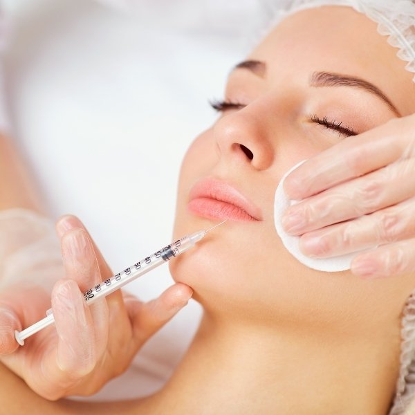 Lip Fillers For The Wedding?