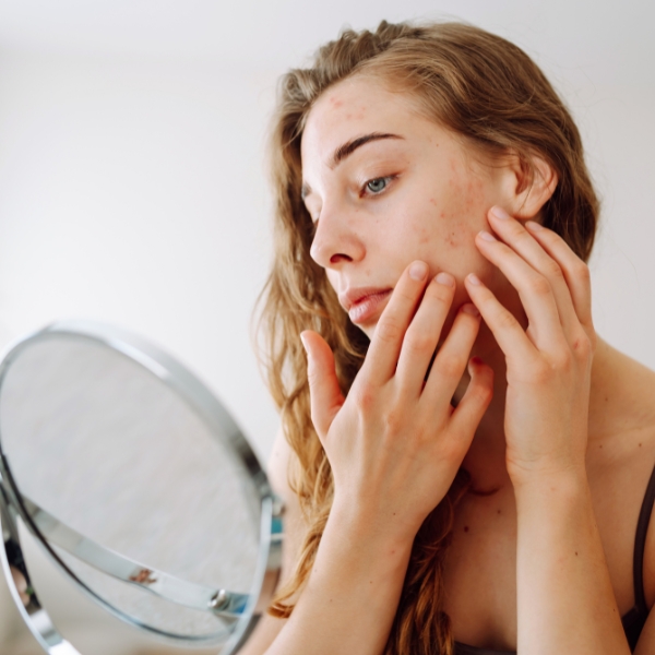 What Are the Signs Your Skincare Products Are Not Working?