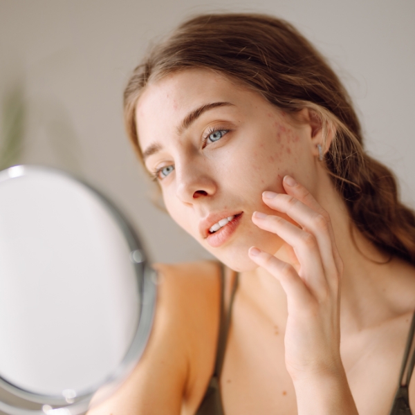 How Does Stress Affect Your Skin and What Can You Do About It?